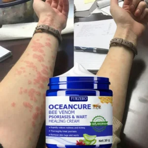 Remifa™ OceanCure Bee Venom Psoriasis & Wart Healing Cream